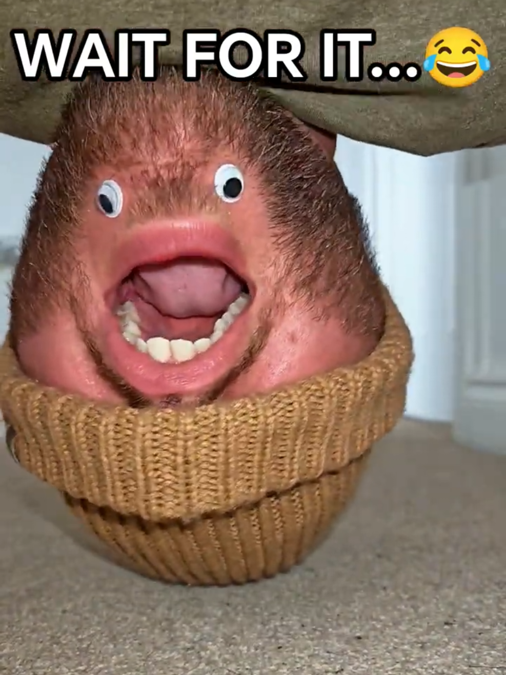 @Chinfaced