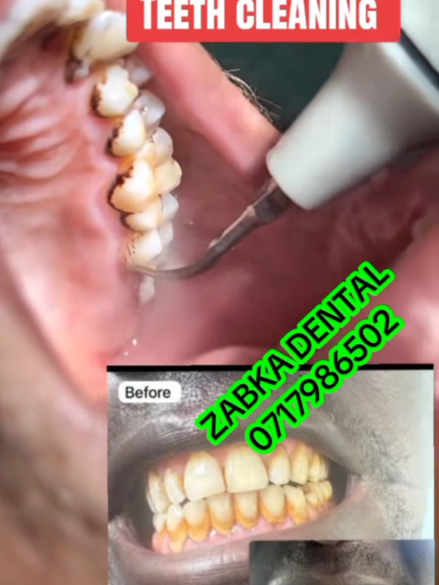 @Zabka Dental