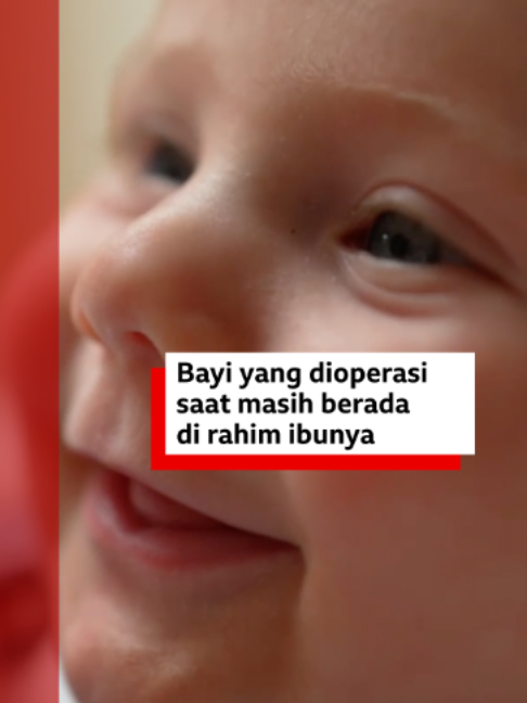 @bbcnewsindonesia