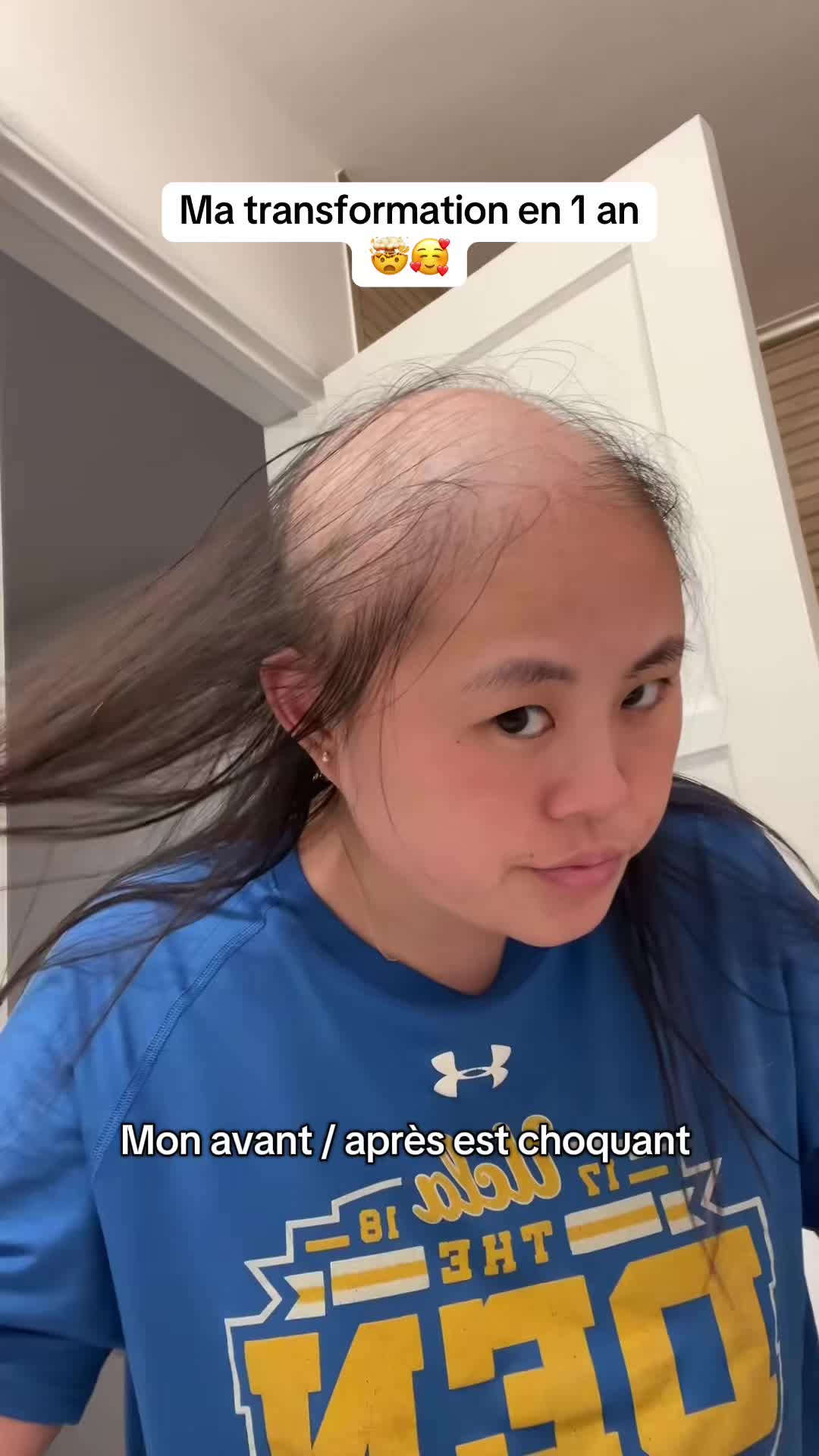 @Lux’Hair Growth FR
