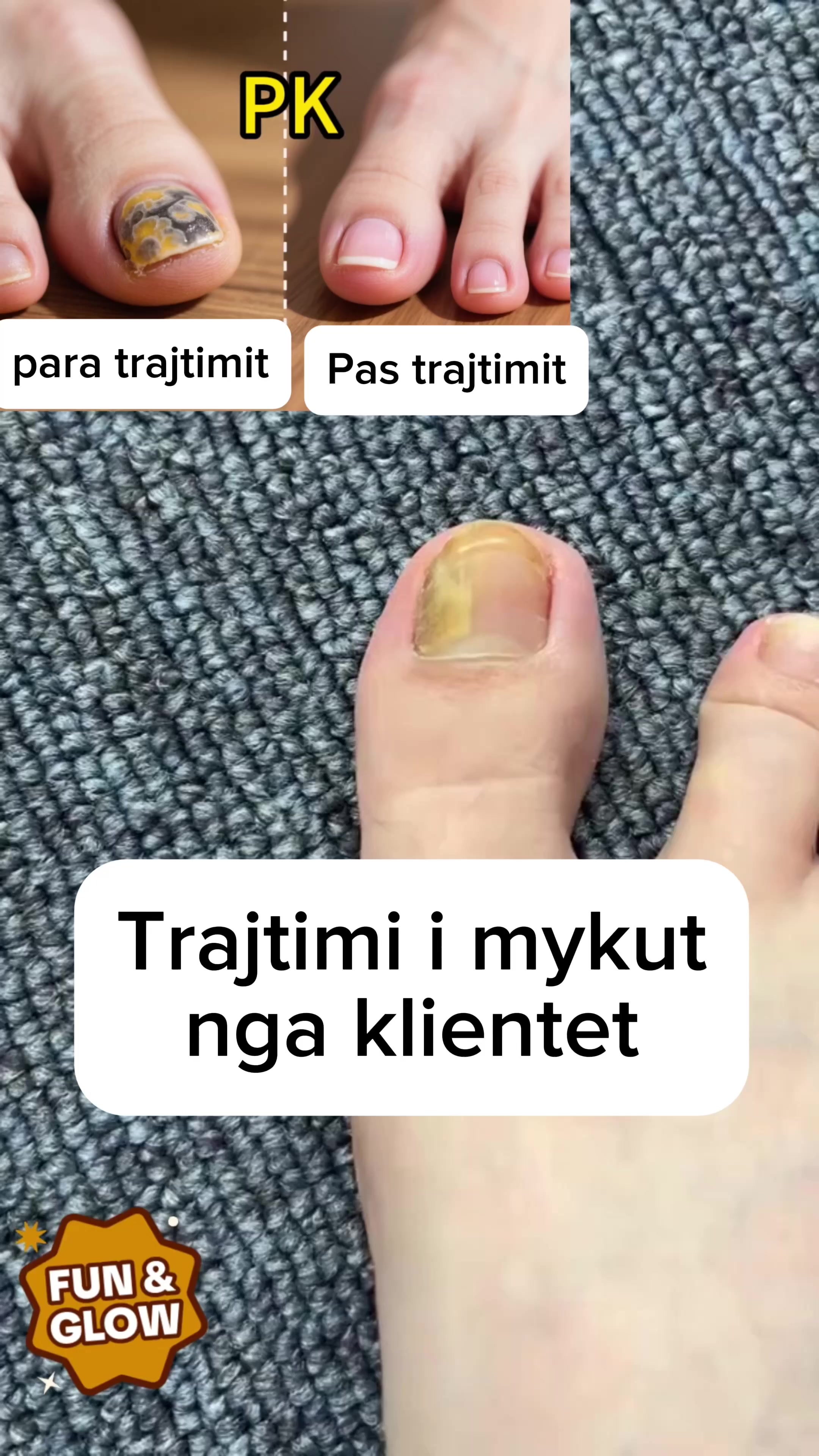 @Lumar