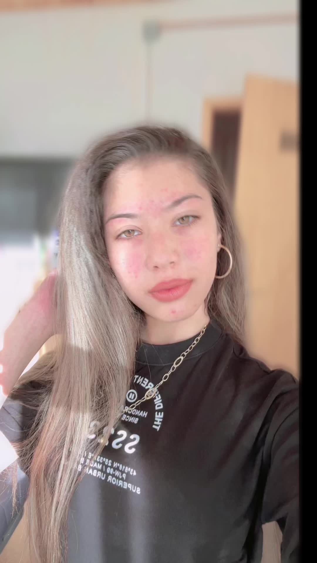 @๐๐ฅ๐