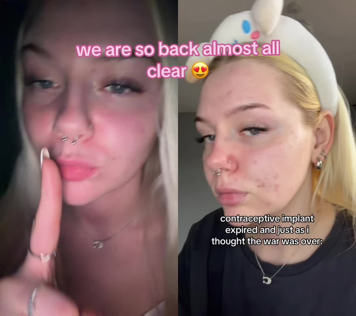 @nataszka 💋