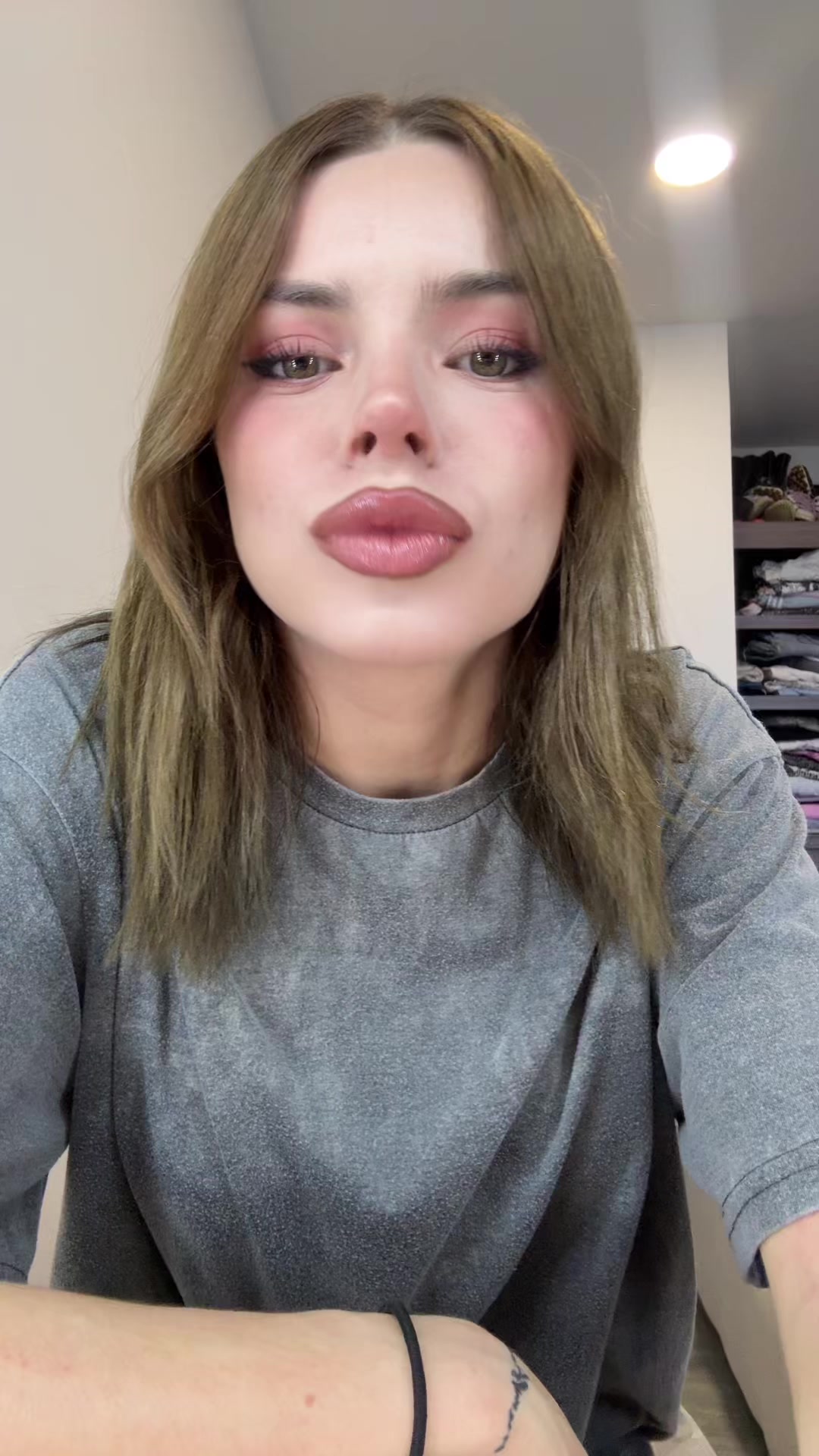 @Dani Zepoll