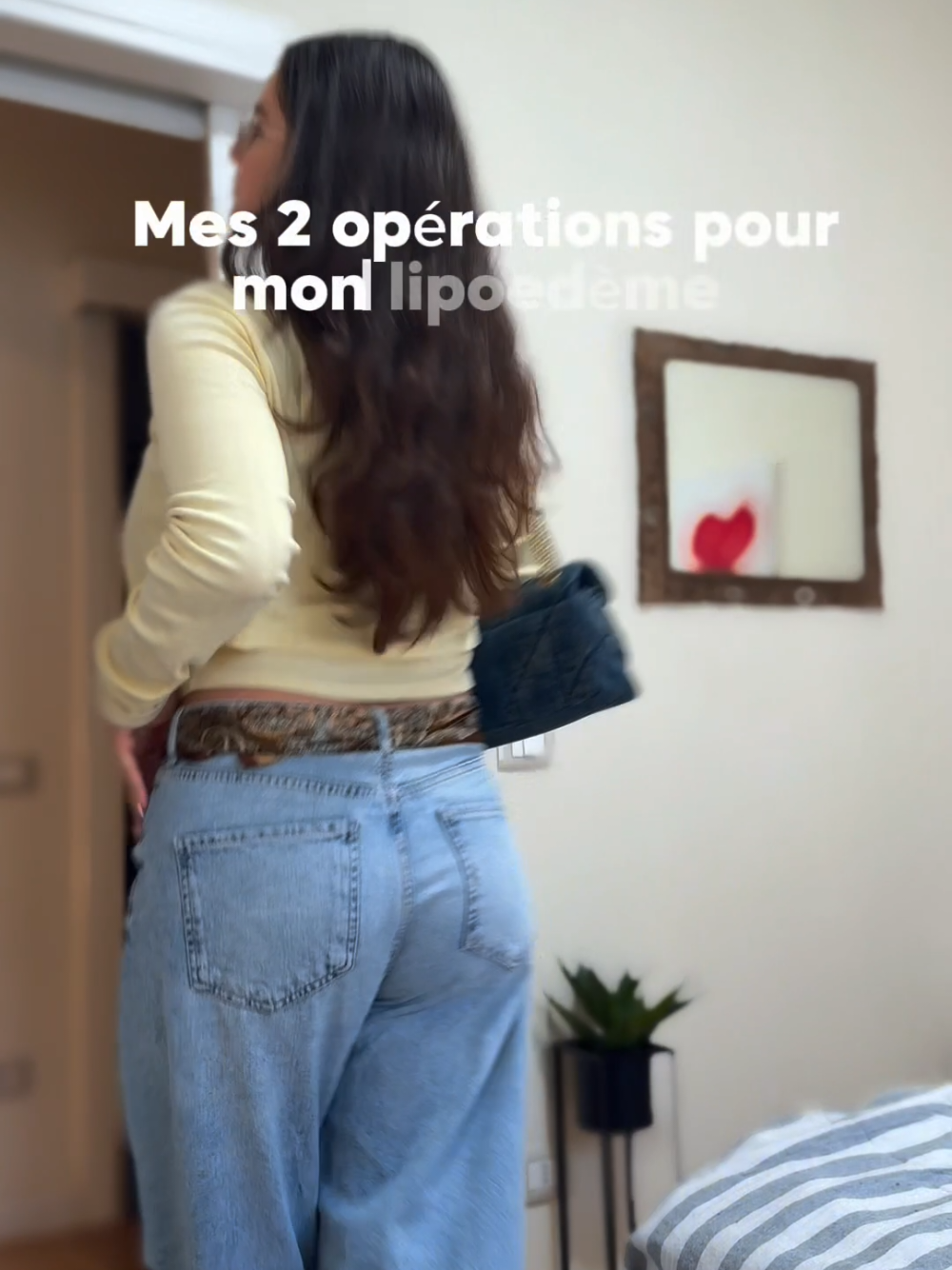 @Vivi-lipoedema