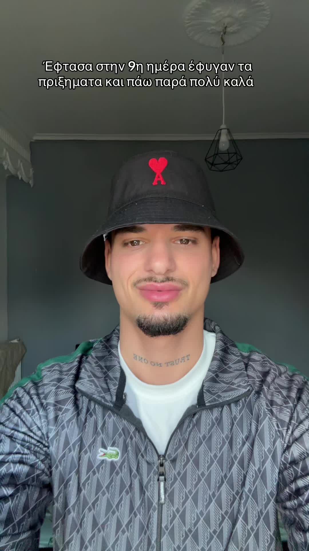 @arapakiss.3