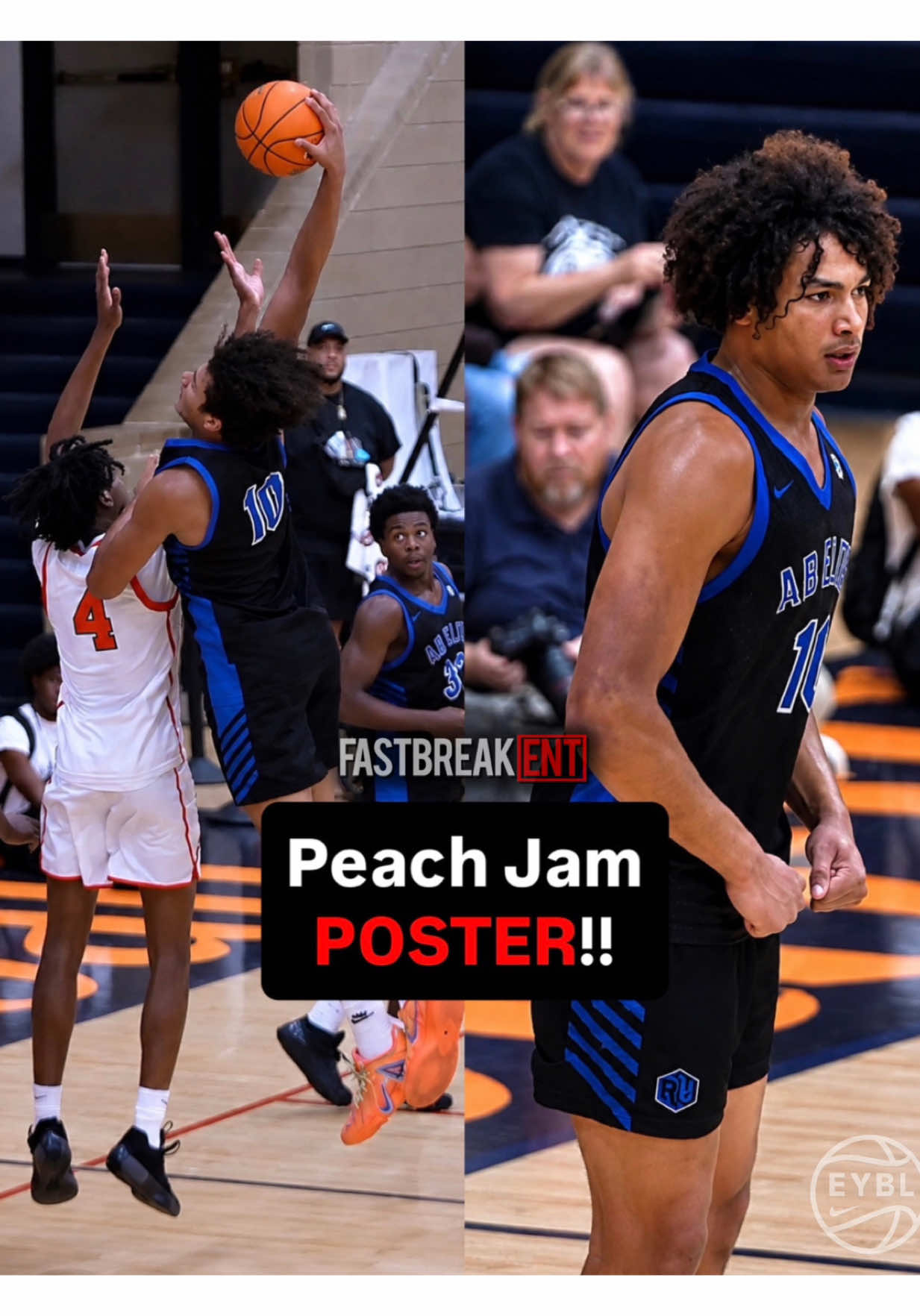 @FastBreak ENT