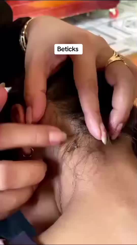 @bbbeee195