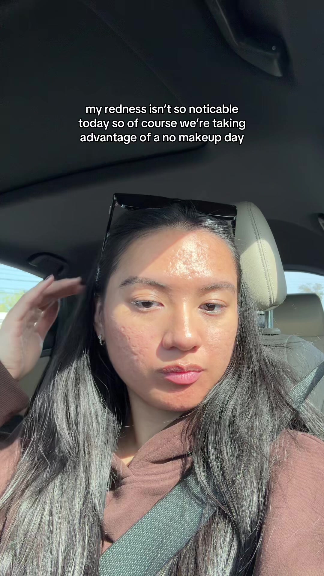 @jennilee • thatacnegirlie