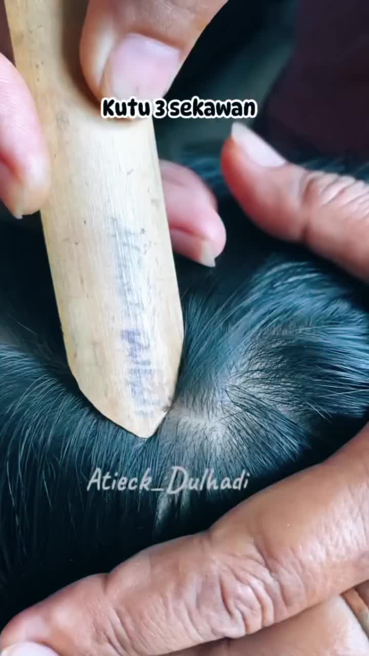 @Atieck dulhadi 🪲💇
