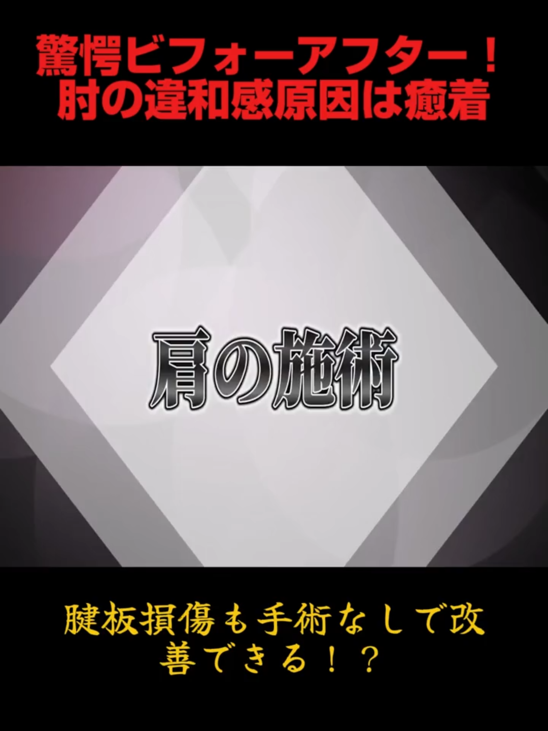 @Yoinno-yoin