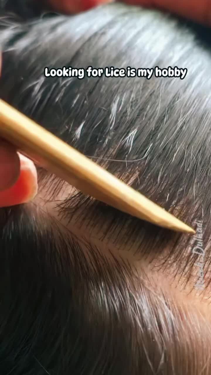 @Atieck dulhadi 🪲💇