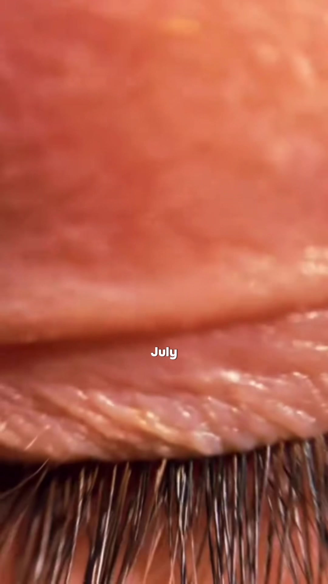 @aestheticteoo