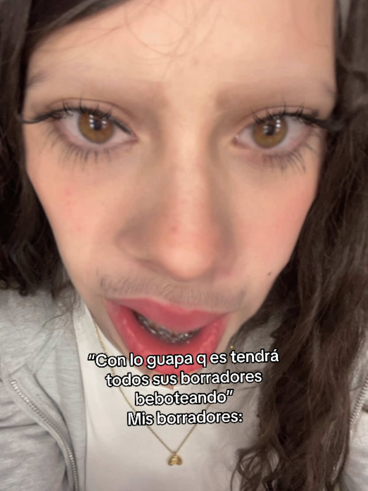 @xxalbaxx01