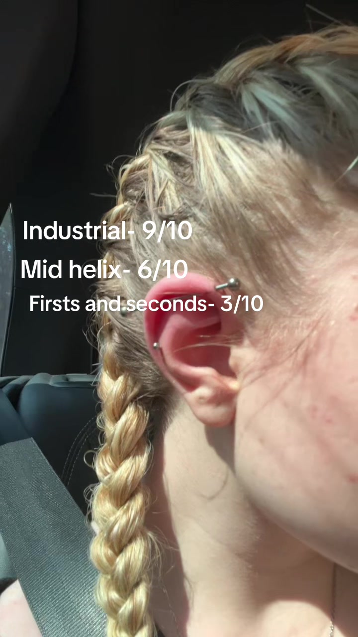@Notchloe