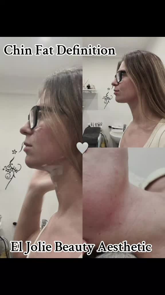 @EL Beauty & Aesthetic