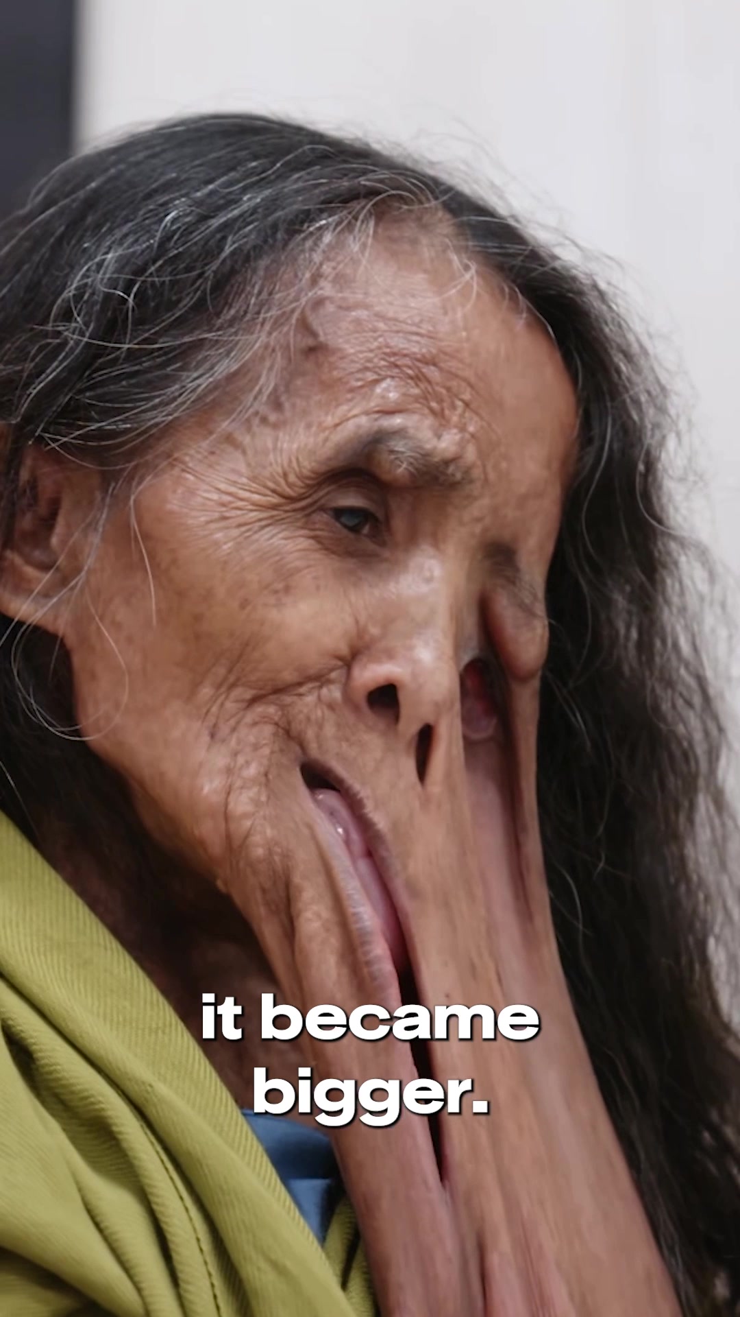 @tlc
