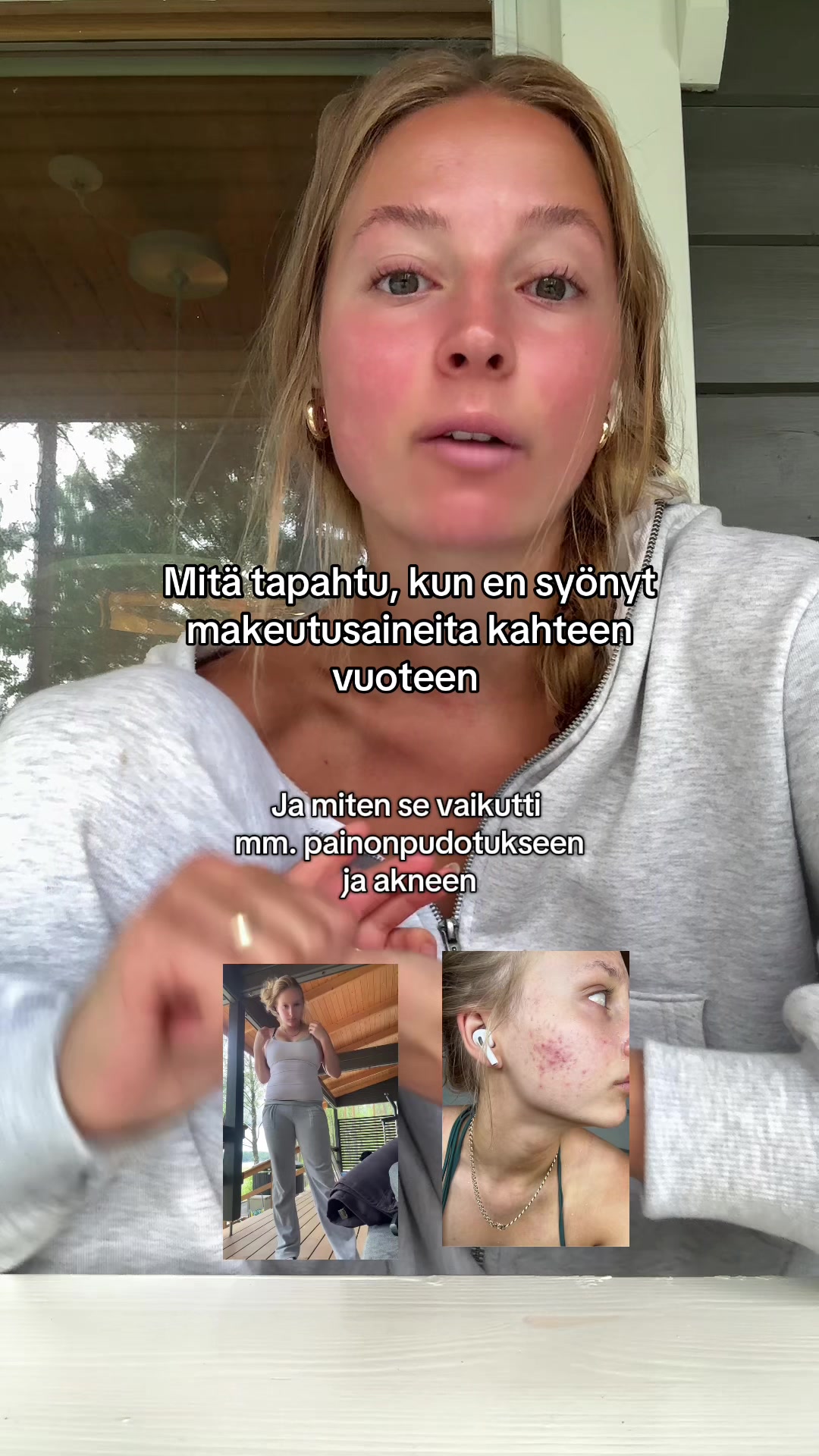 @Noora