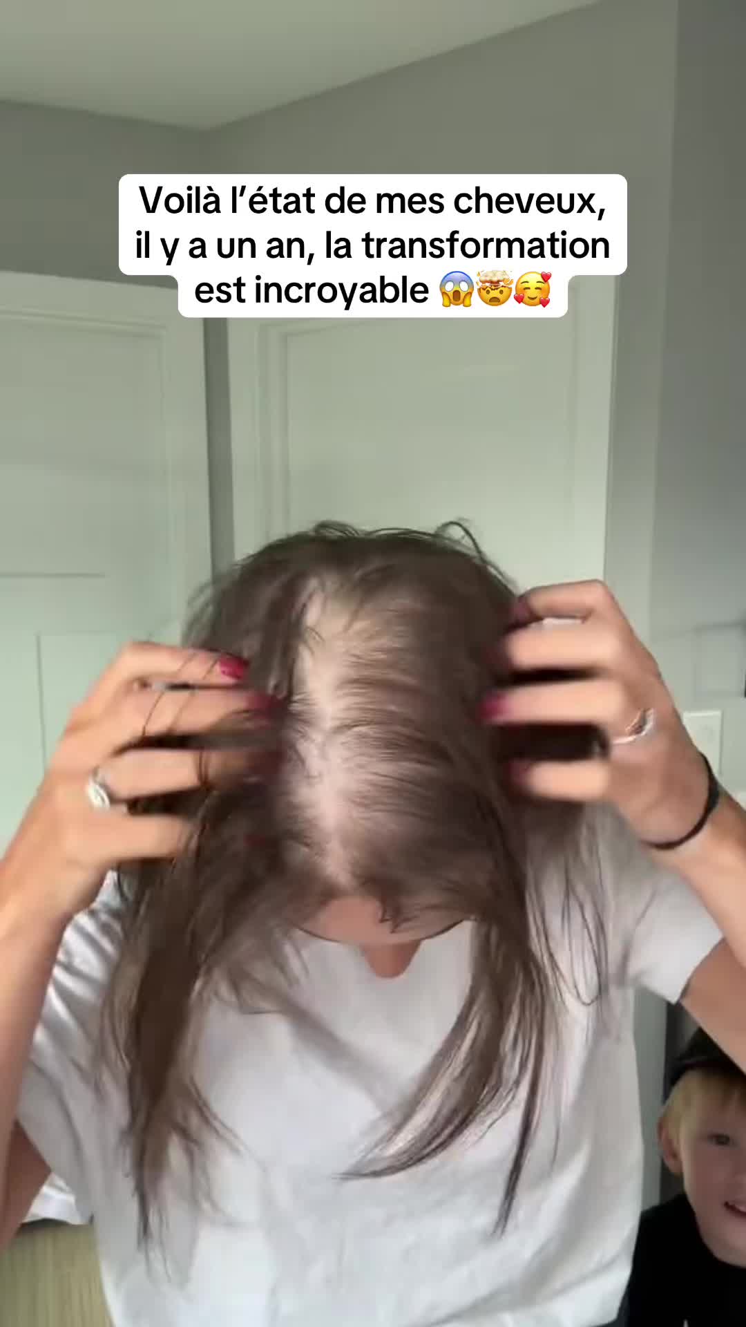 @Lux’Hair Growth