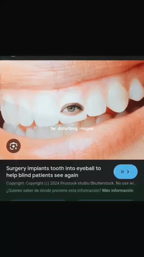 @koooooiiiii