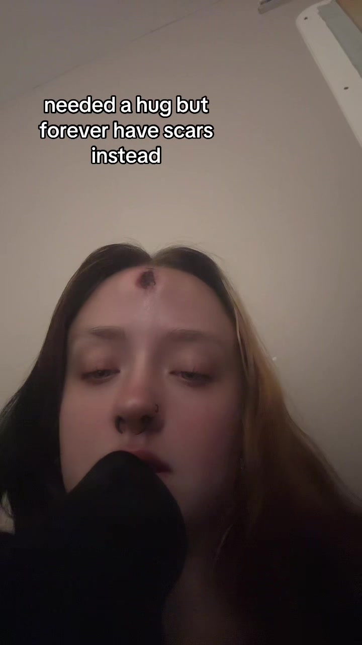 @katieseupdrecovery