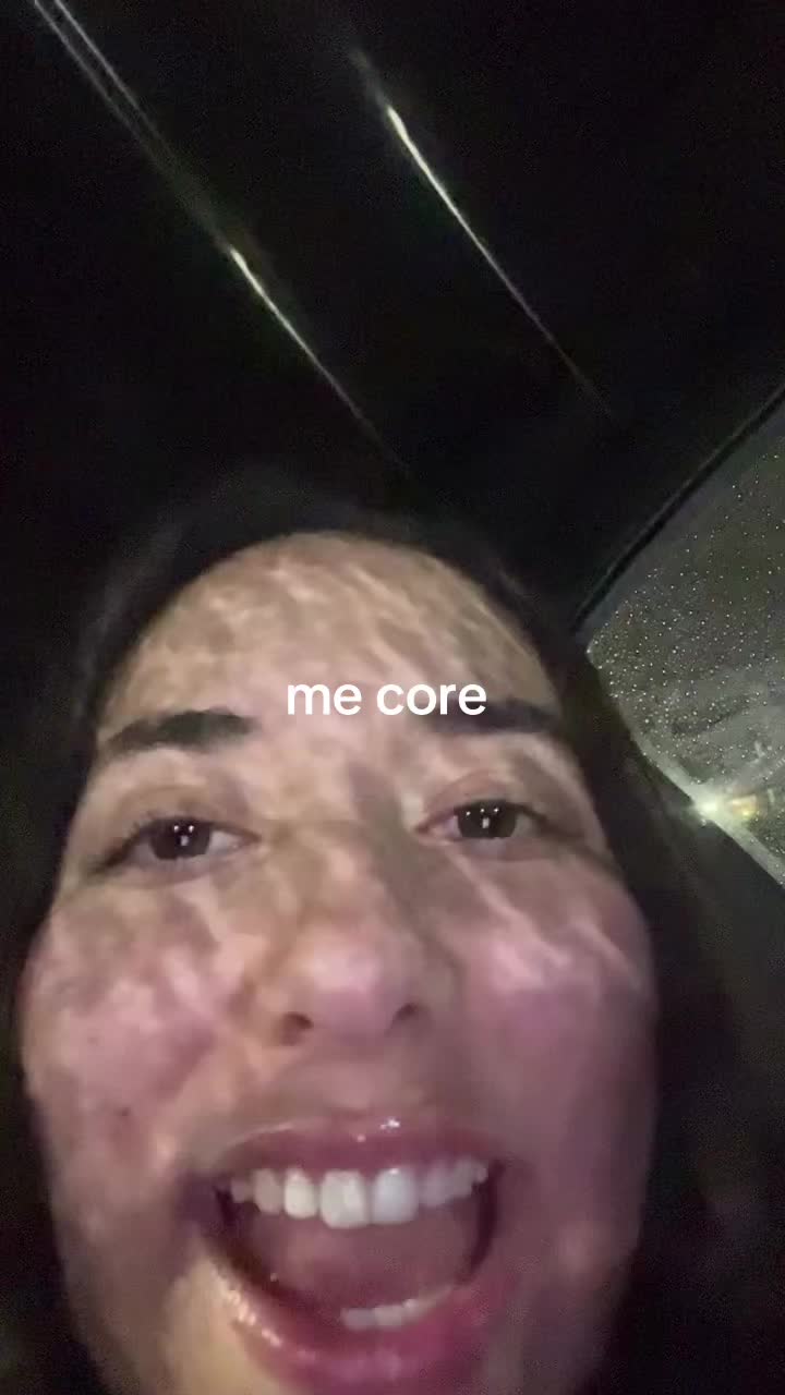 @Pol