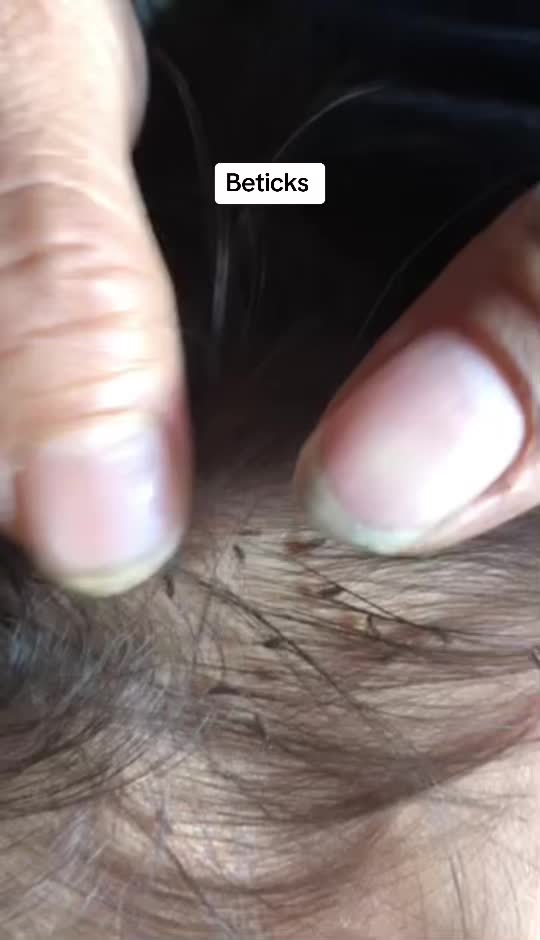@bbbeee195
