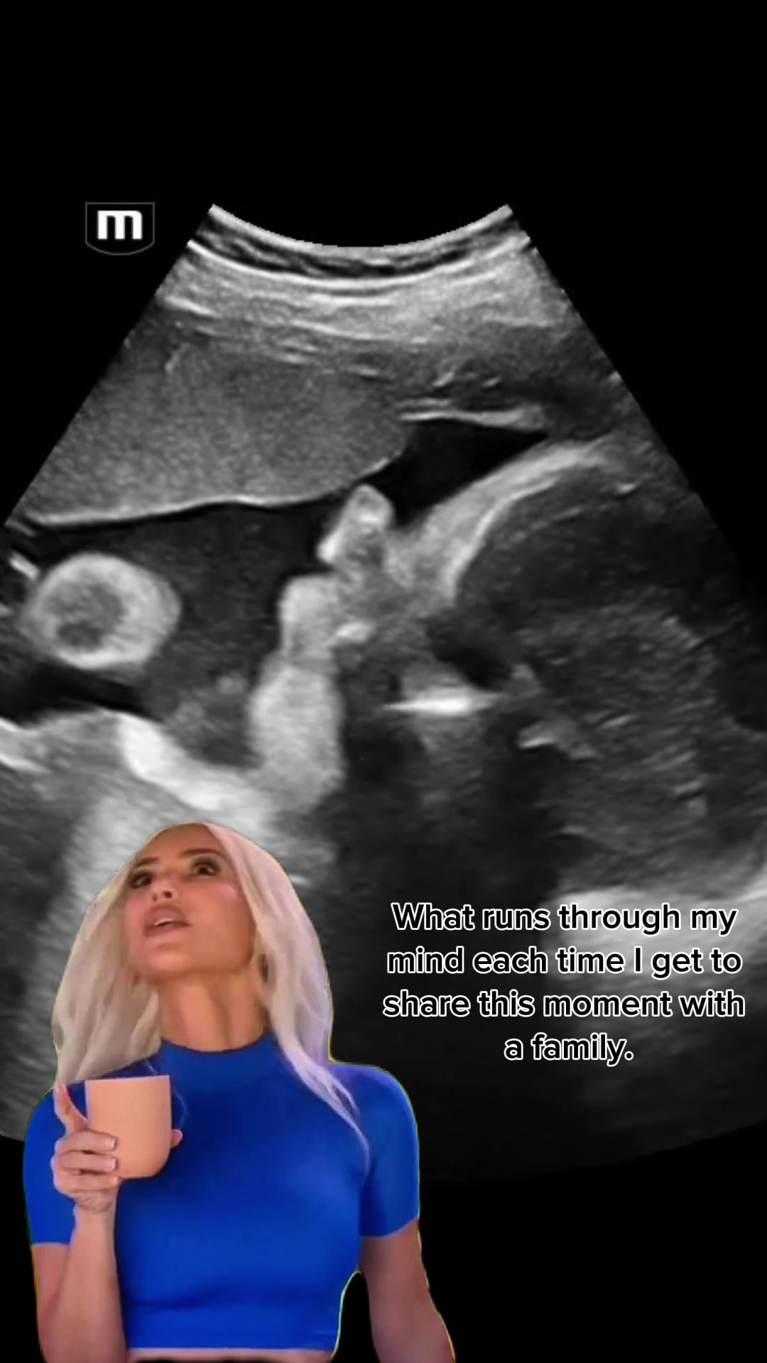 @babyspace3d4d