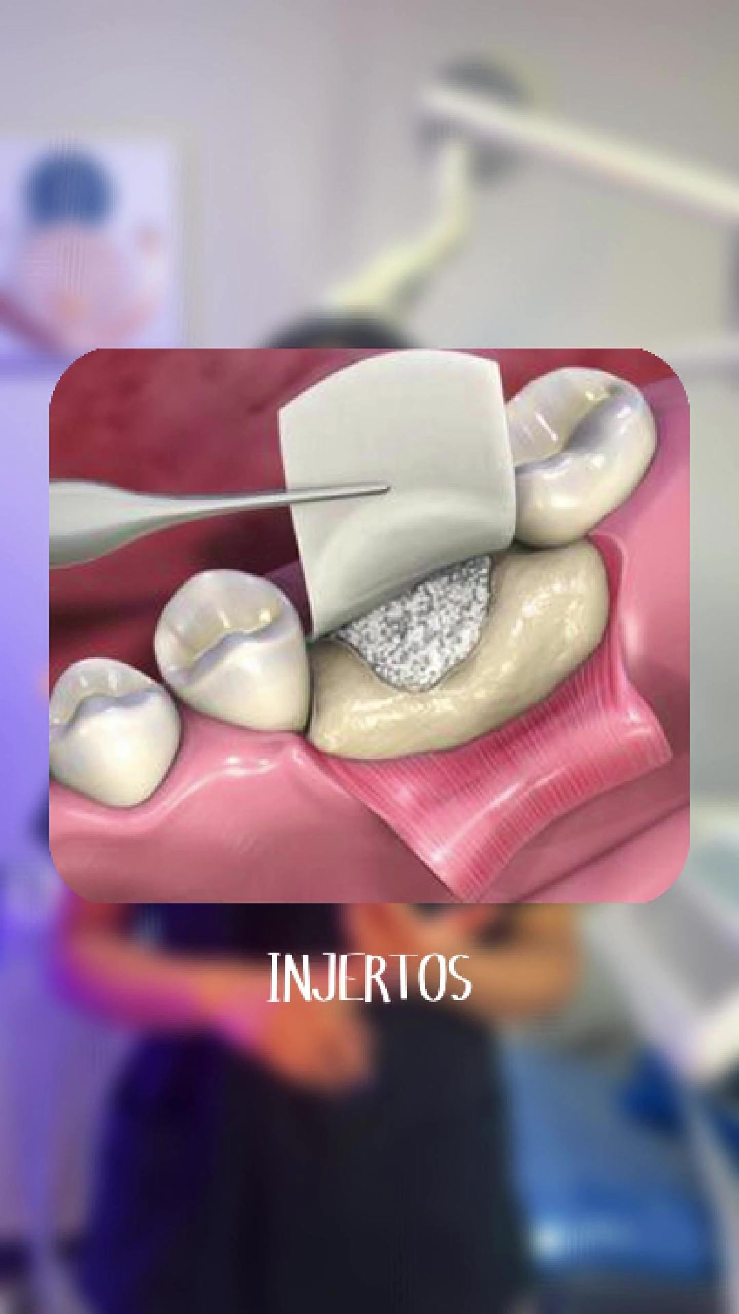 @pro.dental.od