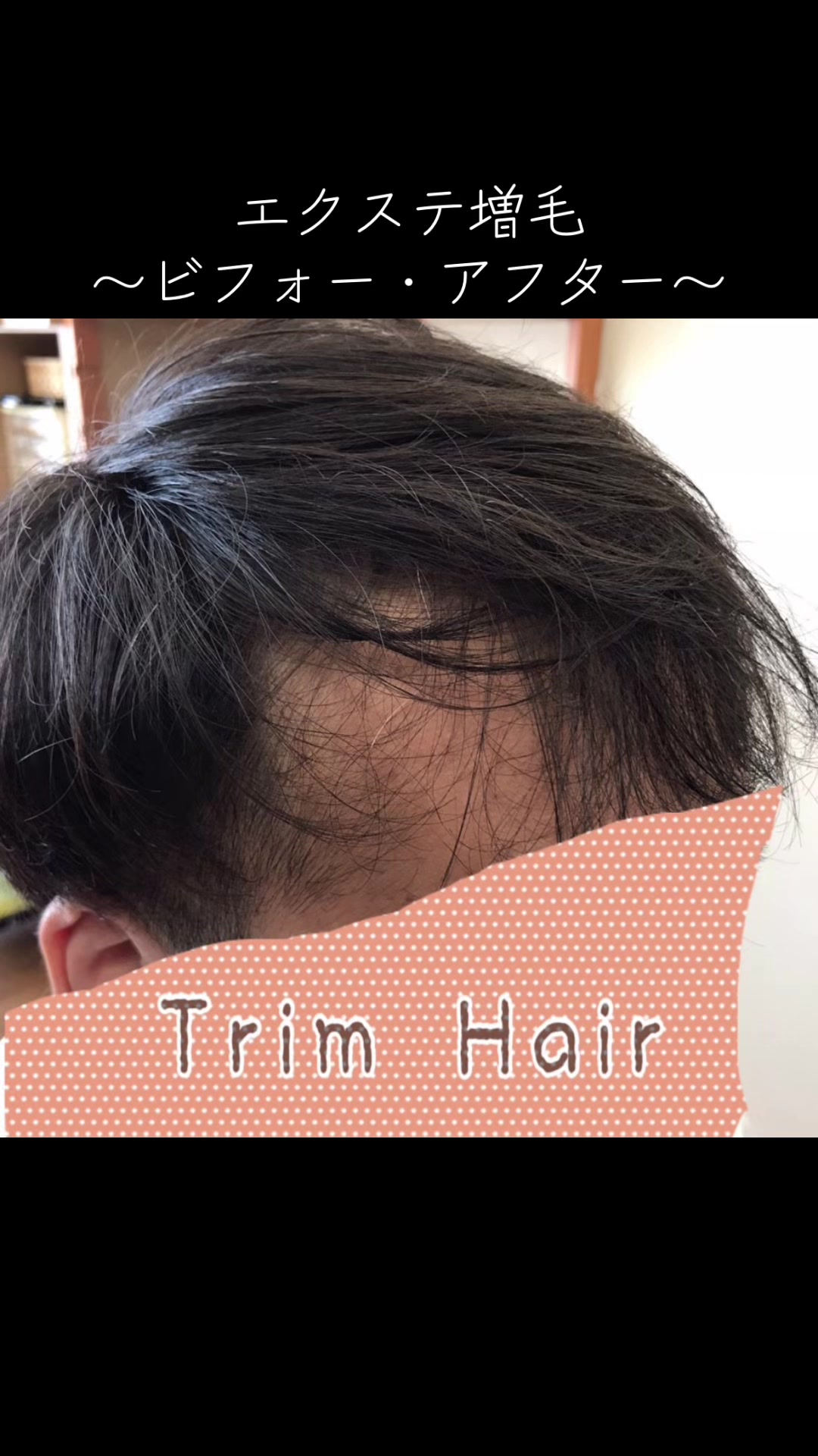 @Trim Hair