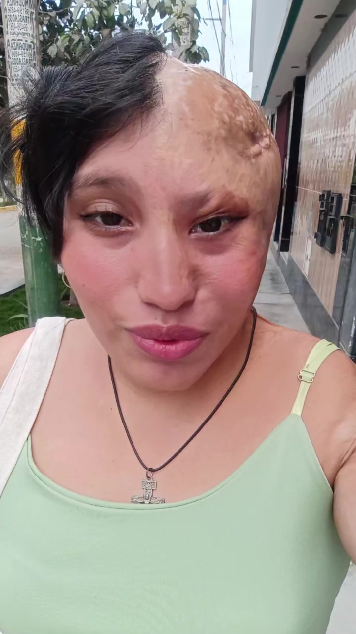 @Elizabeth Carri&oacute;n
