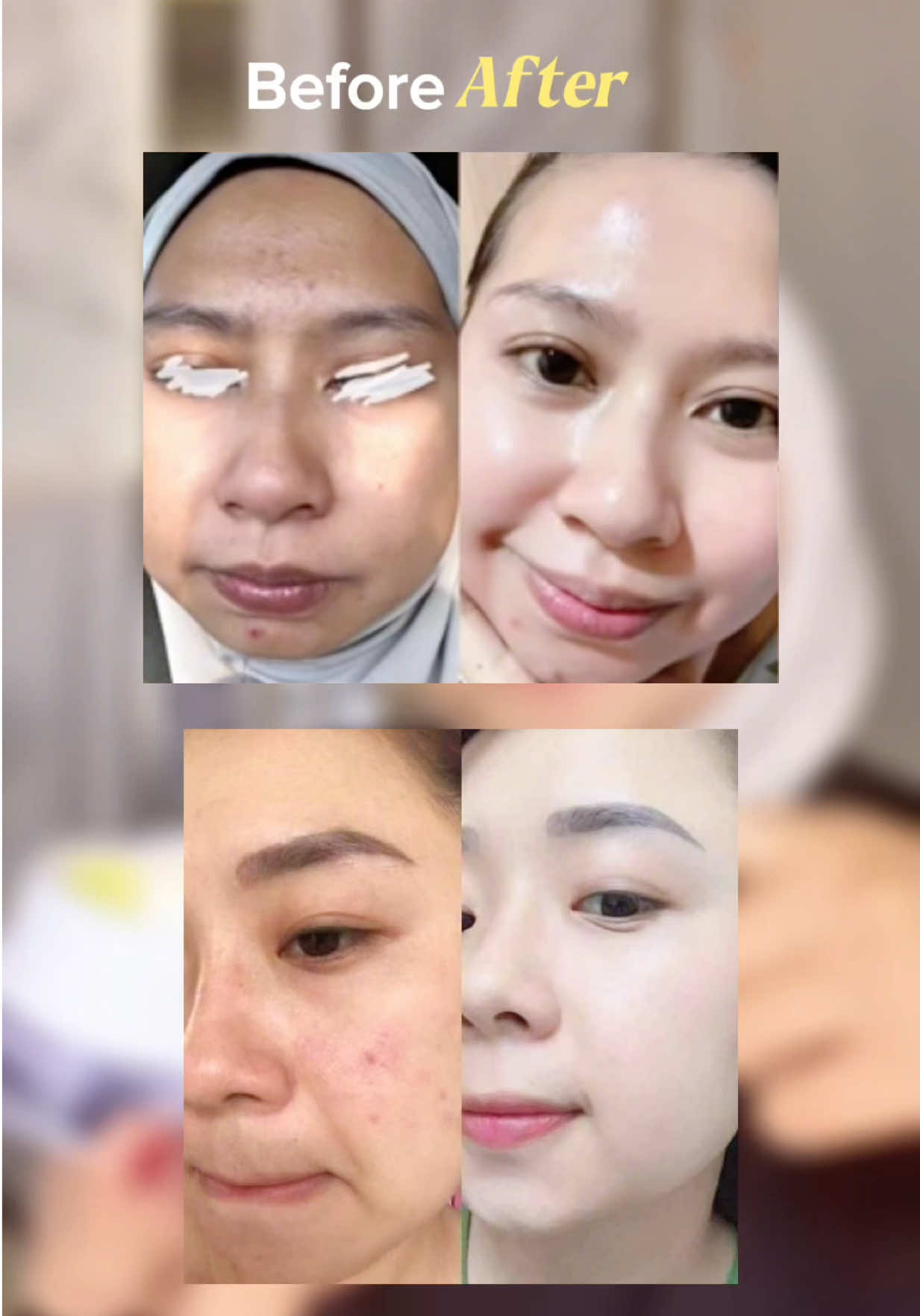 @MAKLON SKINCARE MOQ 50 PCS