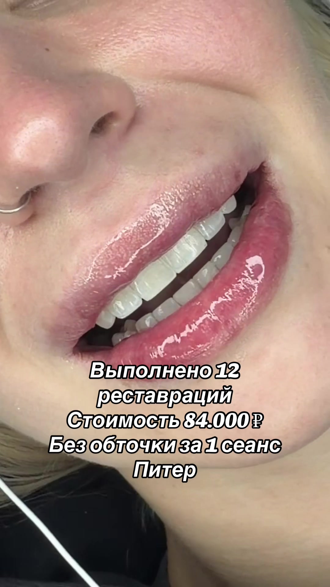 @Royal_smile_moscow