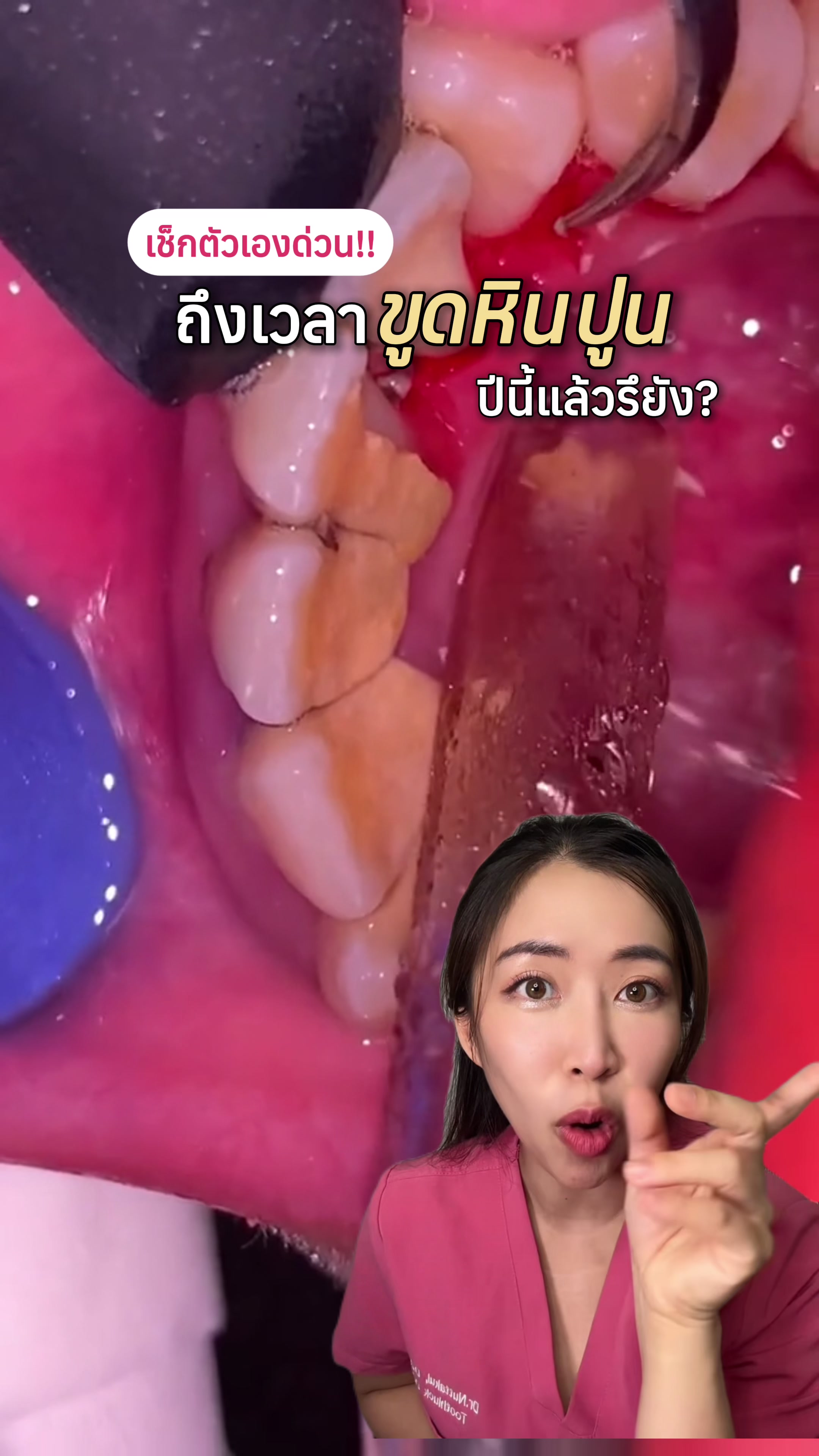 @ณัฐคุณ (Nuttakul Dent) 🦷
