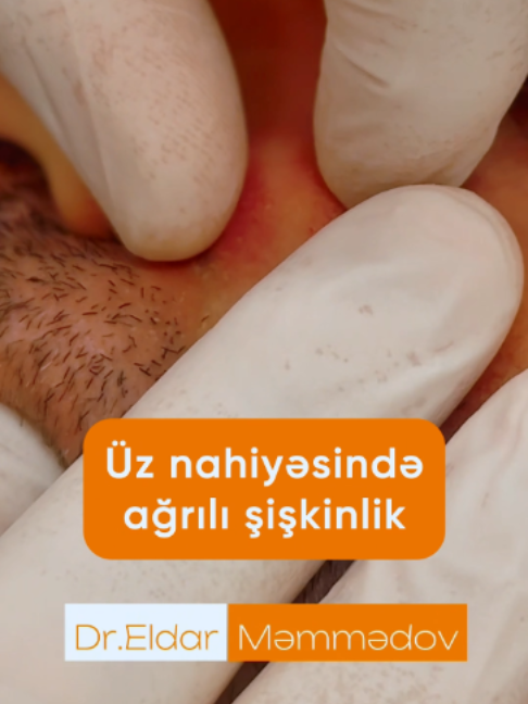 @Dr.Eldar Məmmədov