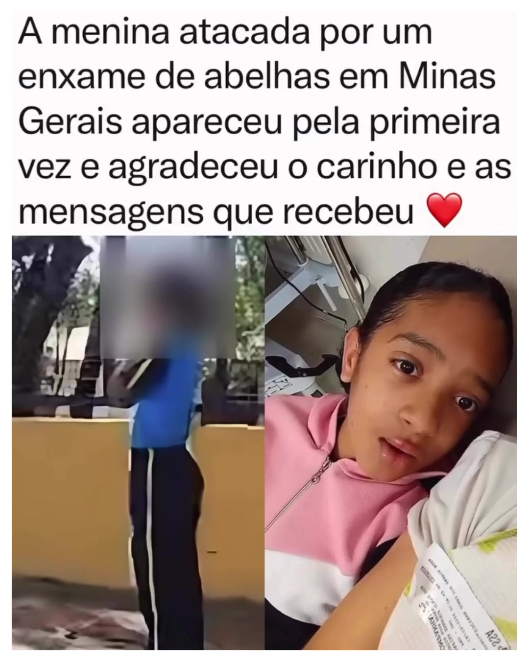 @Alfinetei