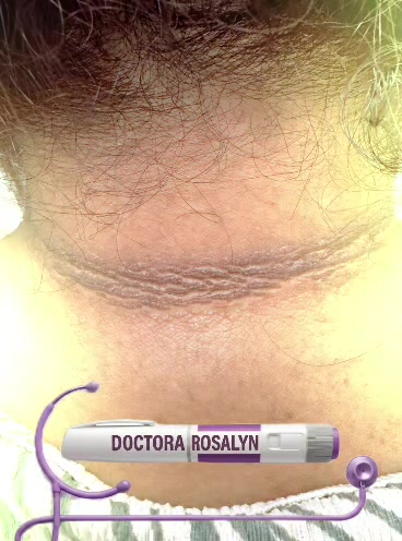 @Tú Endocrino GLP-1 Rosalyn