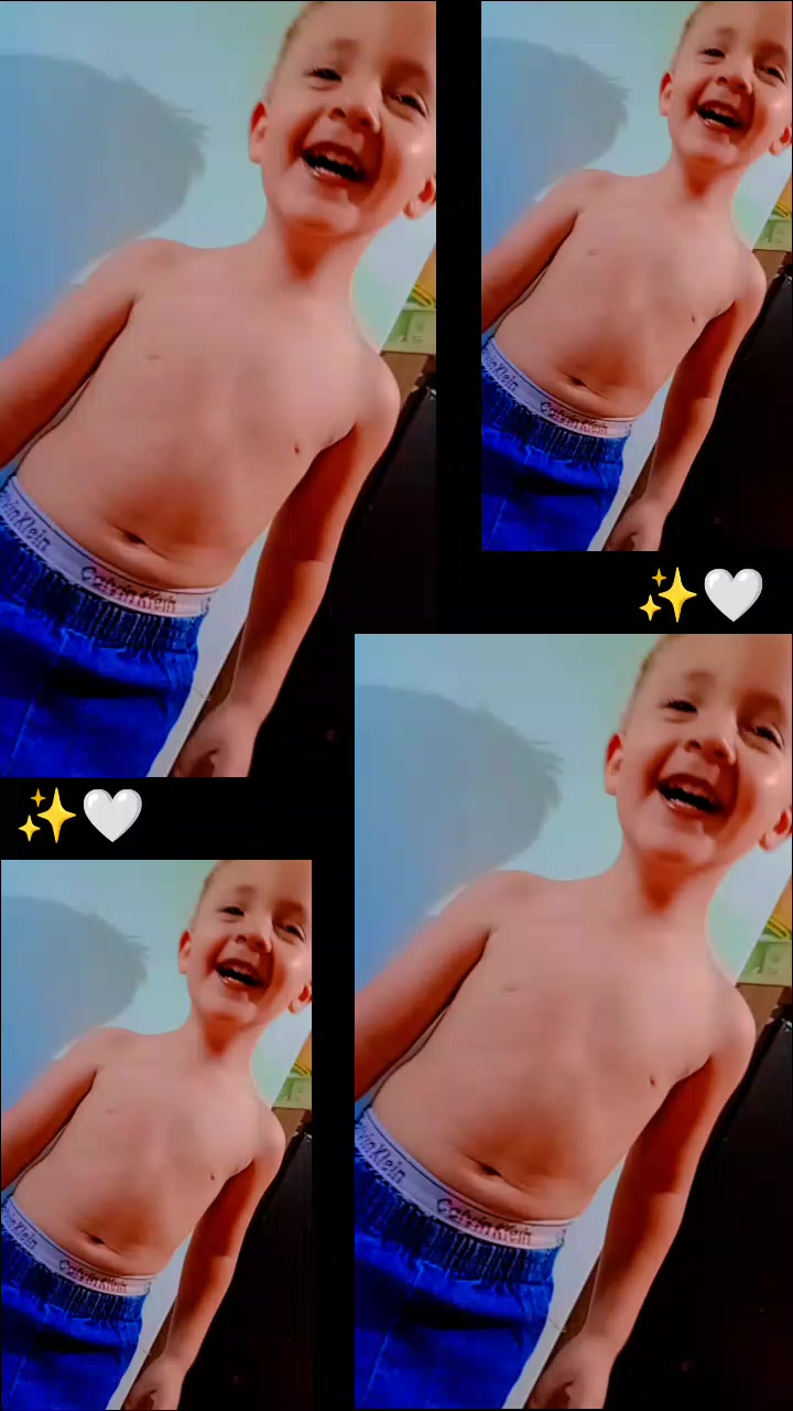 @Henrique amputado🦿