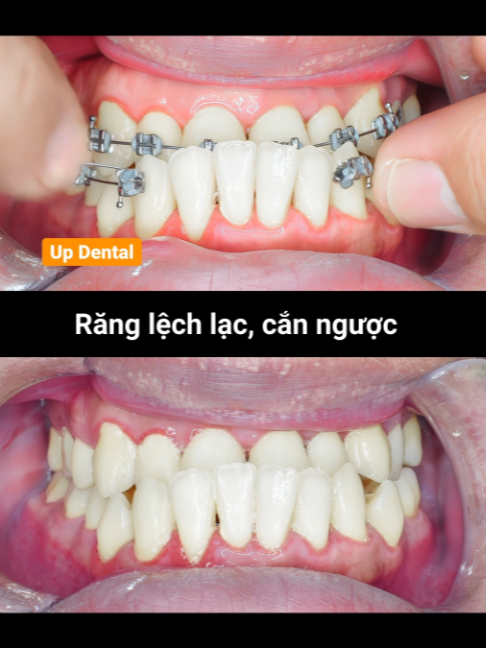 @Nha khoa niềng răng Up Dental