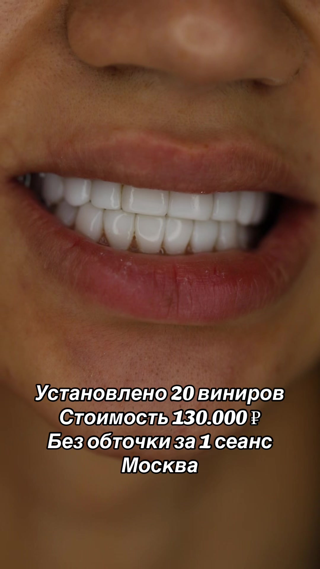 @Royal_smile_moscow