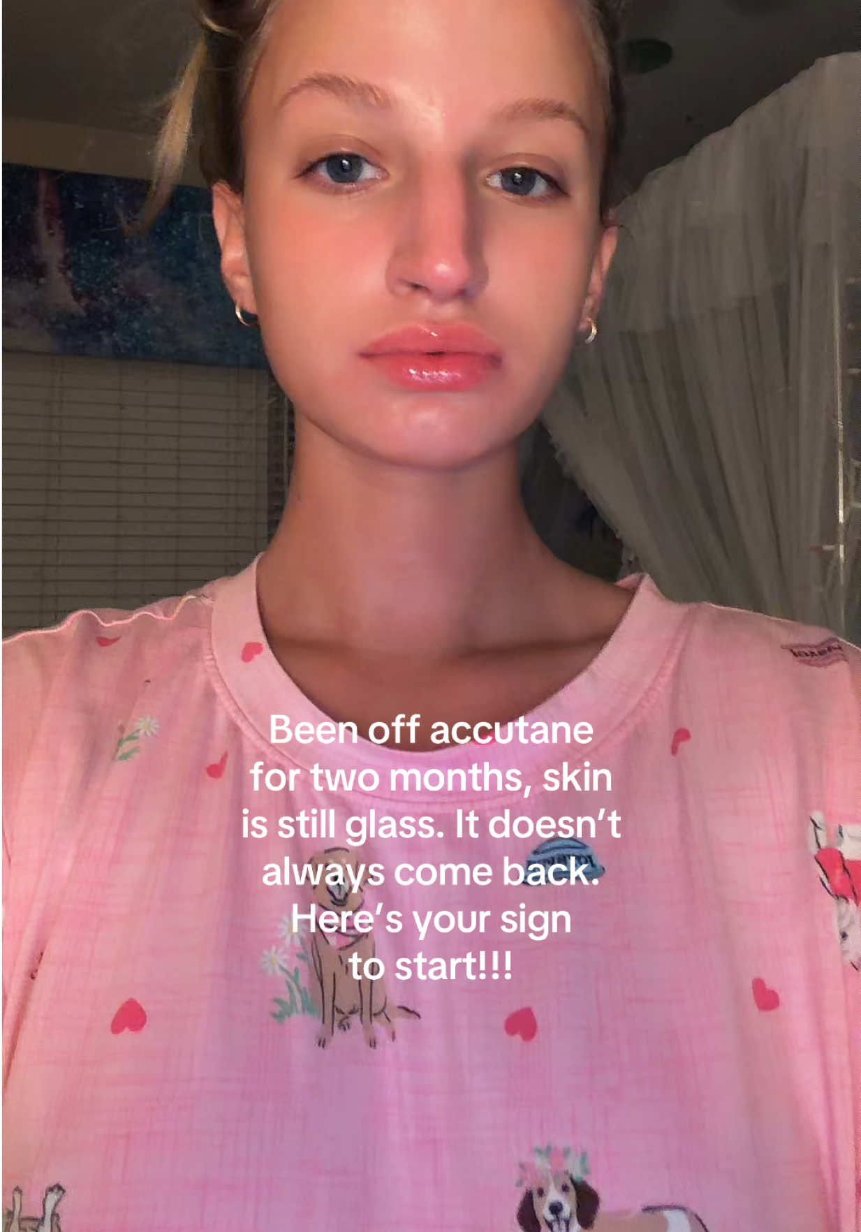 @M