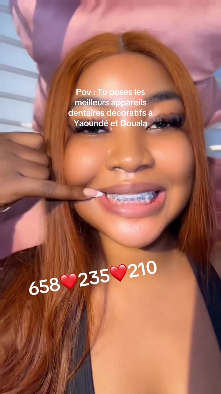 @MG BRACES