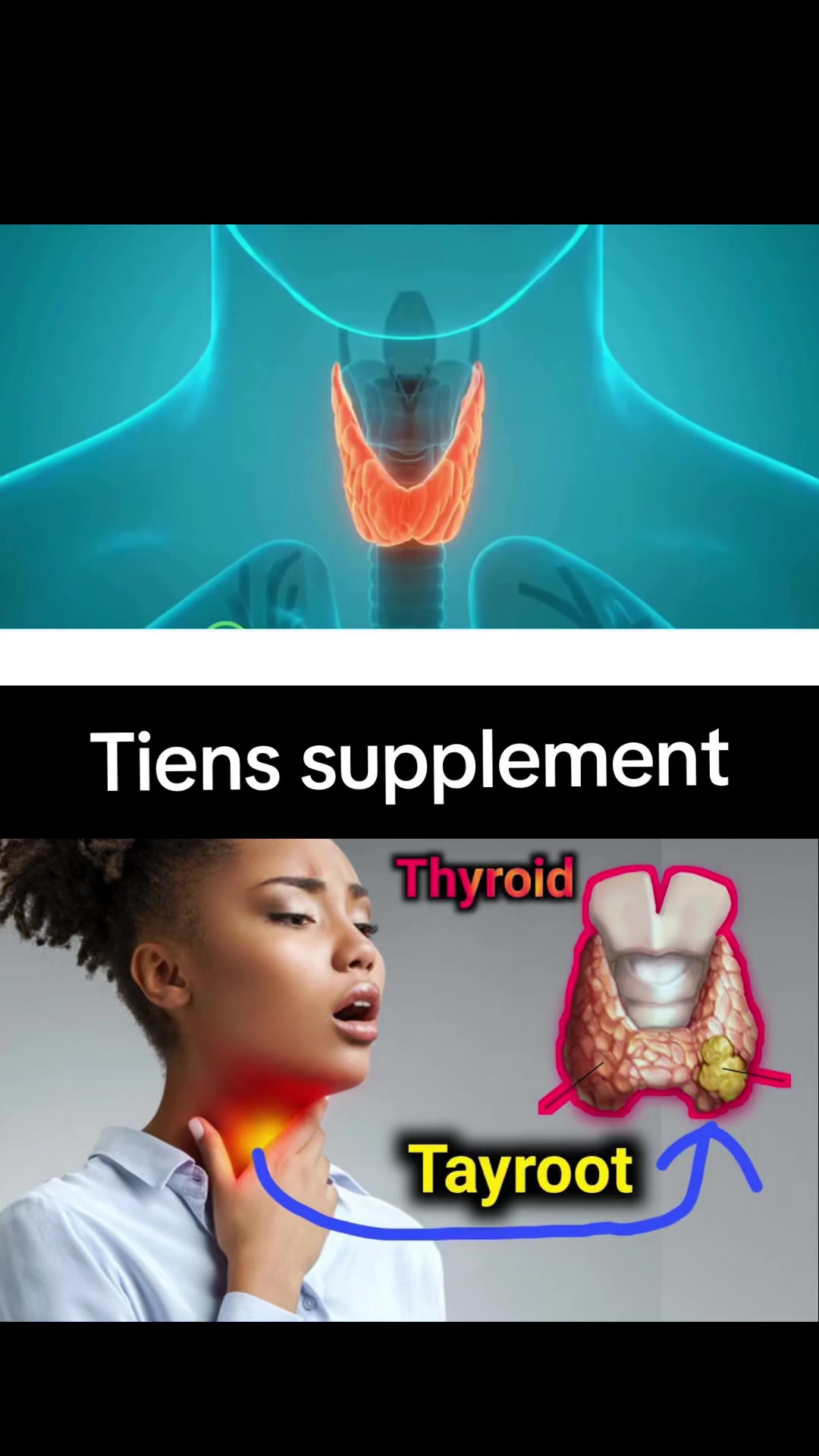 @Tiens Supplements