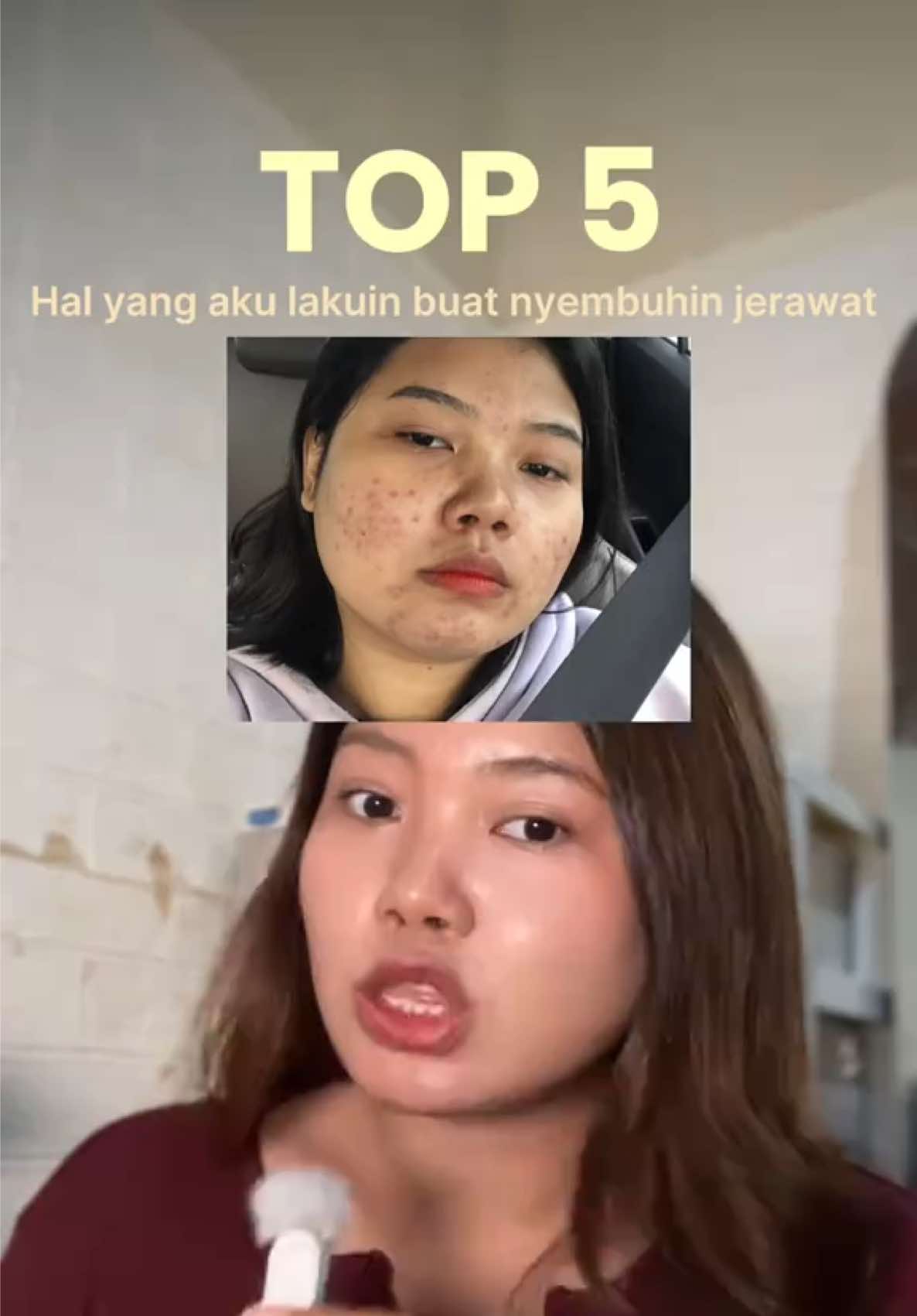 @ichi | glow up journey