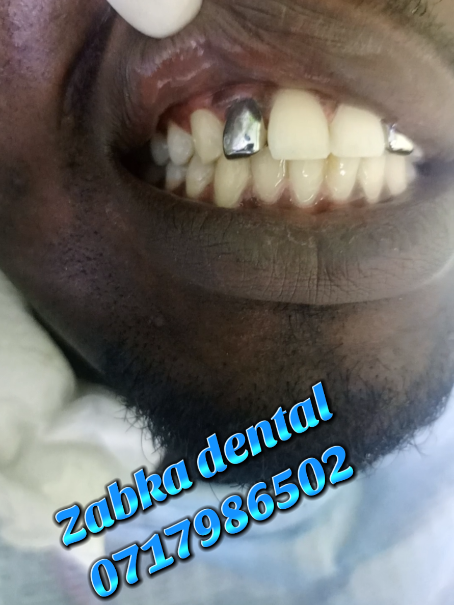 @Zabka Dental