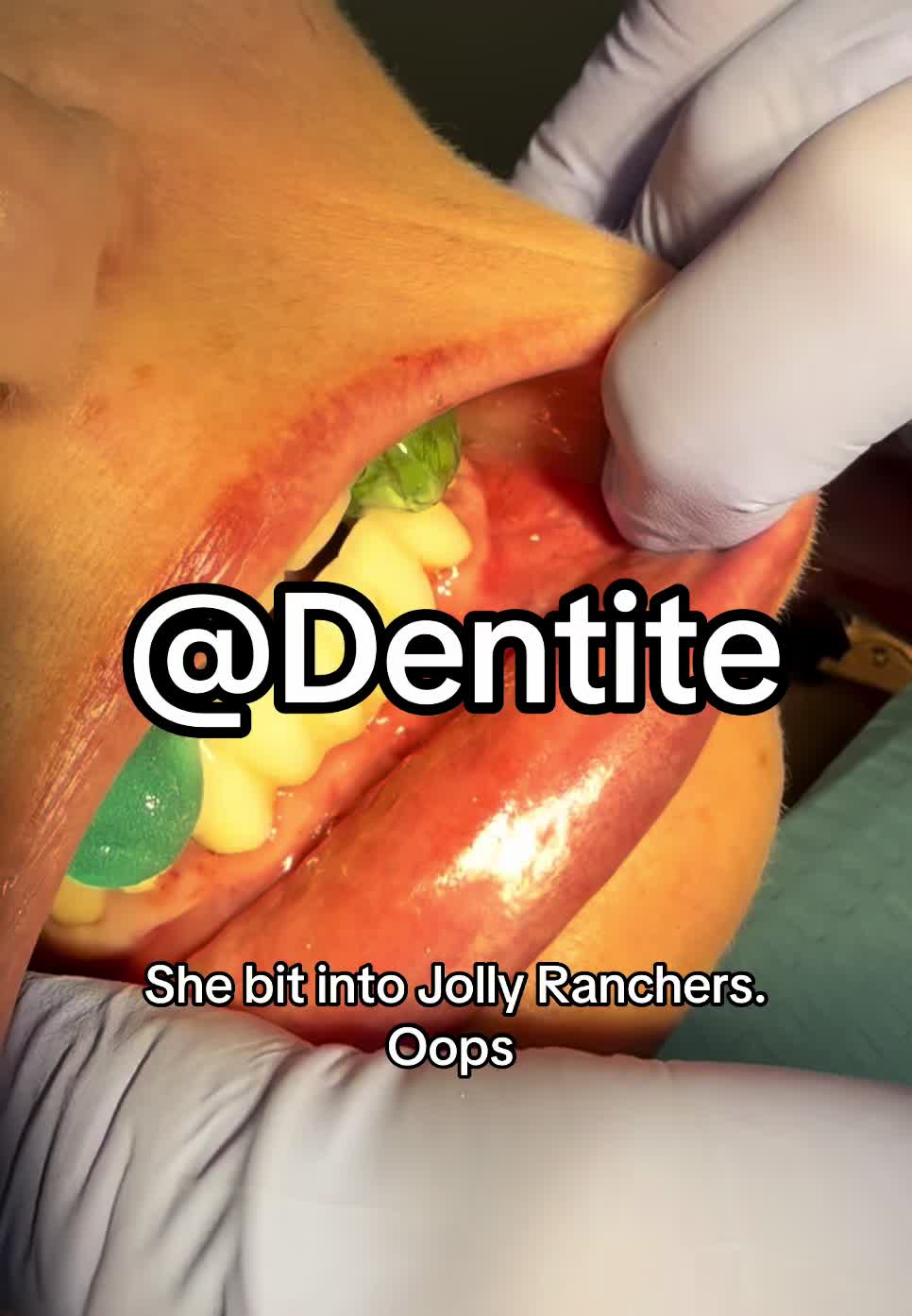 @Dentite