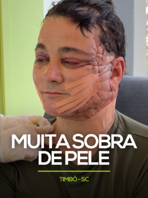 @Dr. Rafael Evaristo