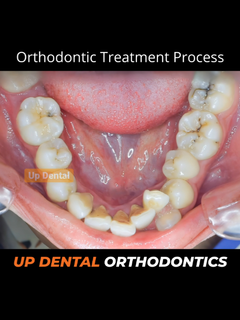 @Nha khoa niềng răng Up Dental