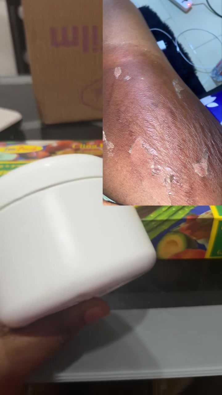 @@ Precious peeling soap