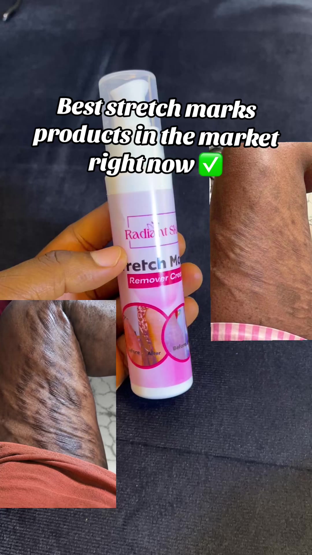@Radiant skin